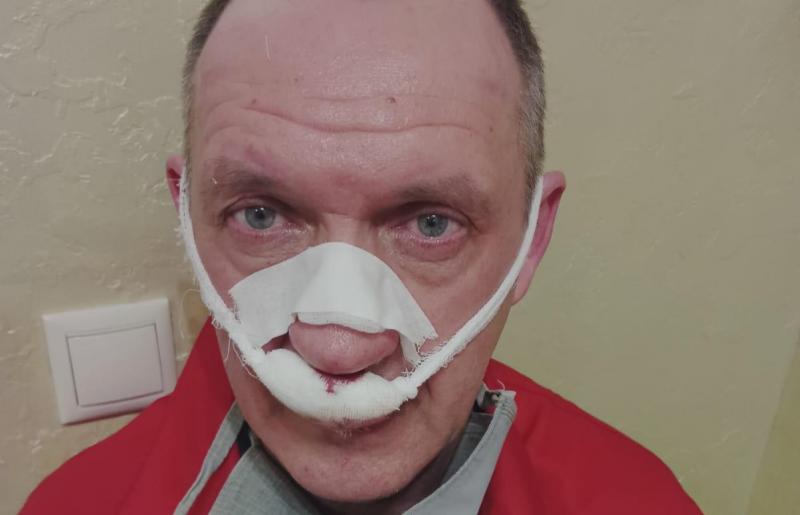 В краевой БСМП избили ещё одного фельдшера "скорой"